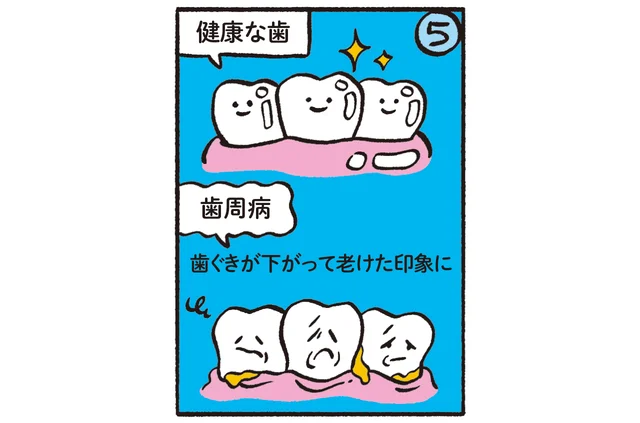 歯周病 歯ぐきが下がって老けた印象に