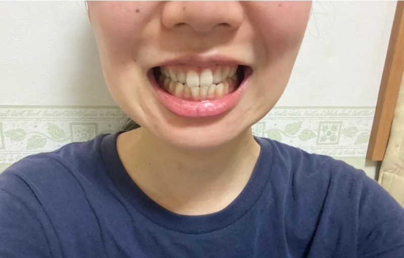 【おうちケア】毎日の歯ブラシで口腔ケアaの画像_6