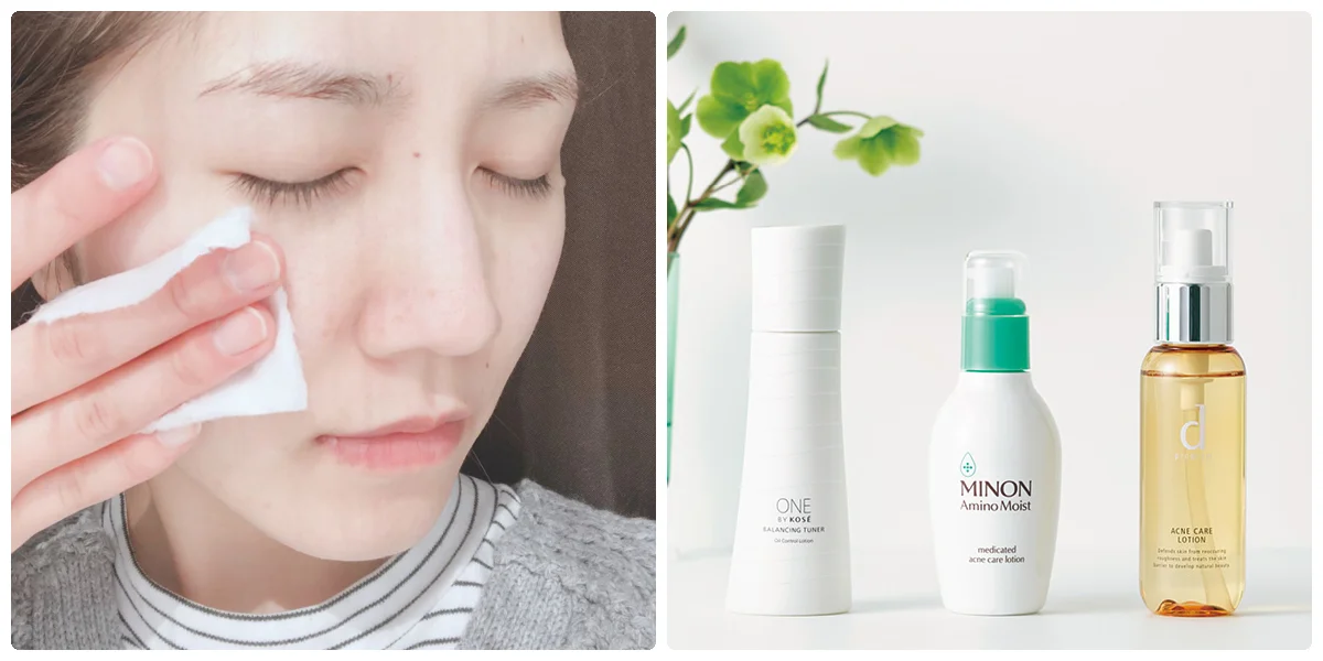 代女子におすすめのニキビケア特集 化粧水や洗顔 ニキビパッチなどニキビケアアイテムまとめ ビューティ コスメ メイク ヘア ダイエット More