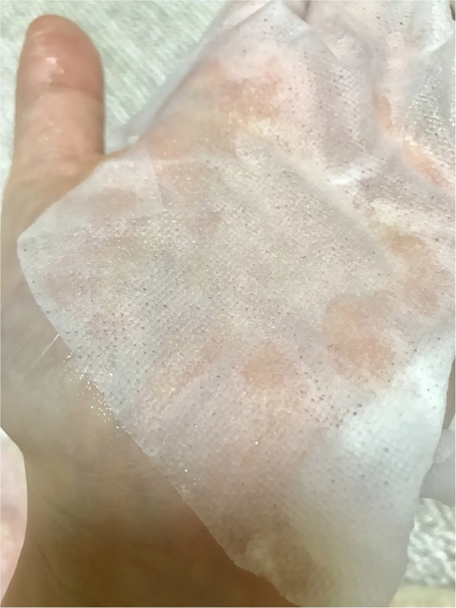 【口コミで話題のアイテム】乾燥肌 敏感肌も安心✩お肌が生き返るうるおい力バツグンのMINONパック!ひと味ちがうのはココ☝︎_3