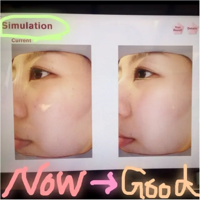 【How old is your skin?】20代も後半。気になる自分の肌年齢!!SK-Ⅱの肌診断受けてみた★あなたの肌年齢は…??_3
