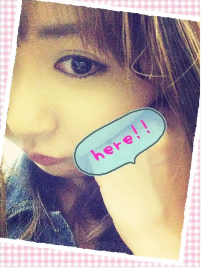 口コミで話題の小顔・美容鍼♡歯医者のわたしが小顔のためにやっていること☻_2