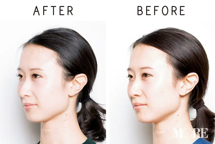 「小顔になれる㊙コスメ」で、むくみ解消もはり感UPも! 憧れの"顔ちっちゃ!"美人が教える名品5選 記事Photo Gallery_1_8