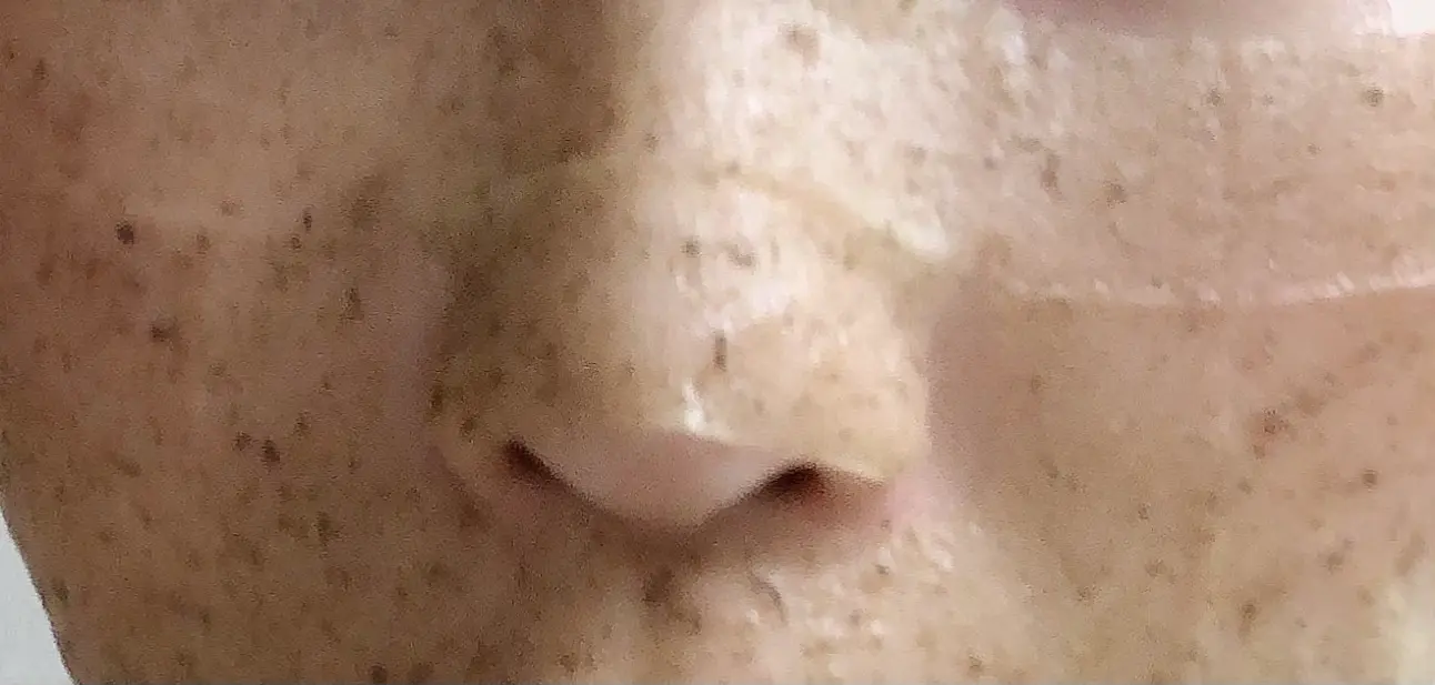 パックを使っている図