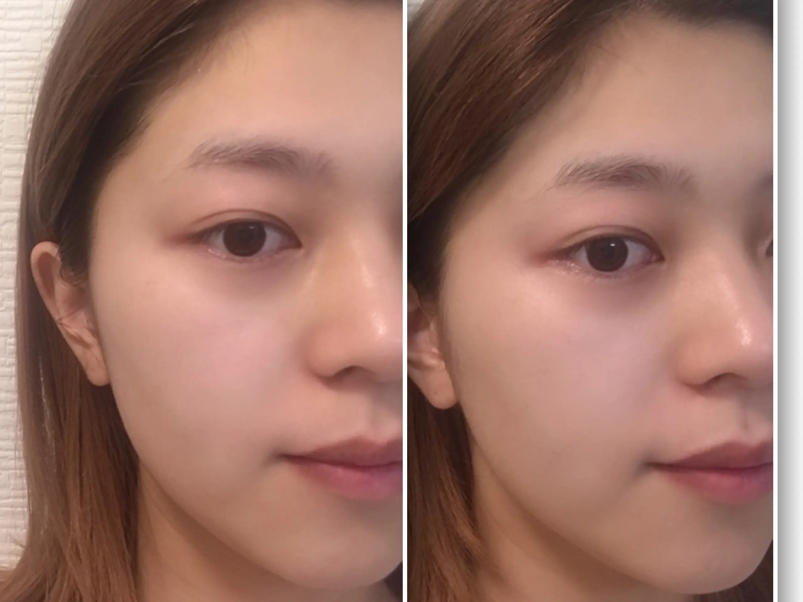 【美肌になりたい人必見】あの女優も使っている話題の炭酸ガスパックを使ってみた!_5