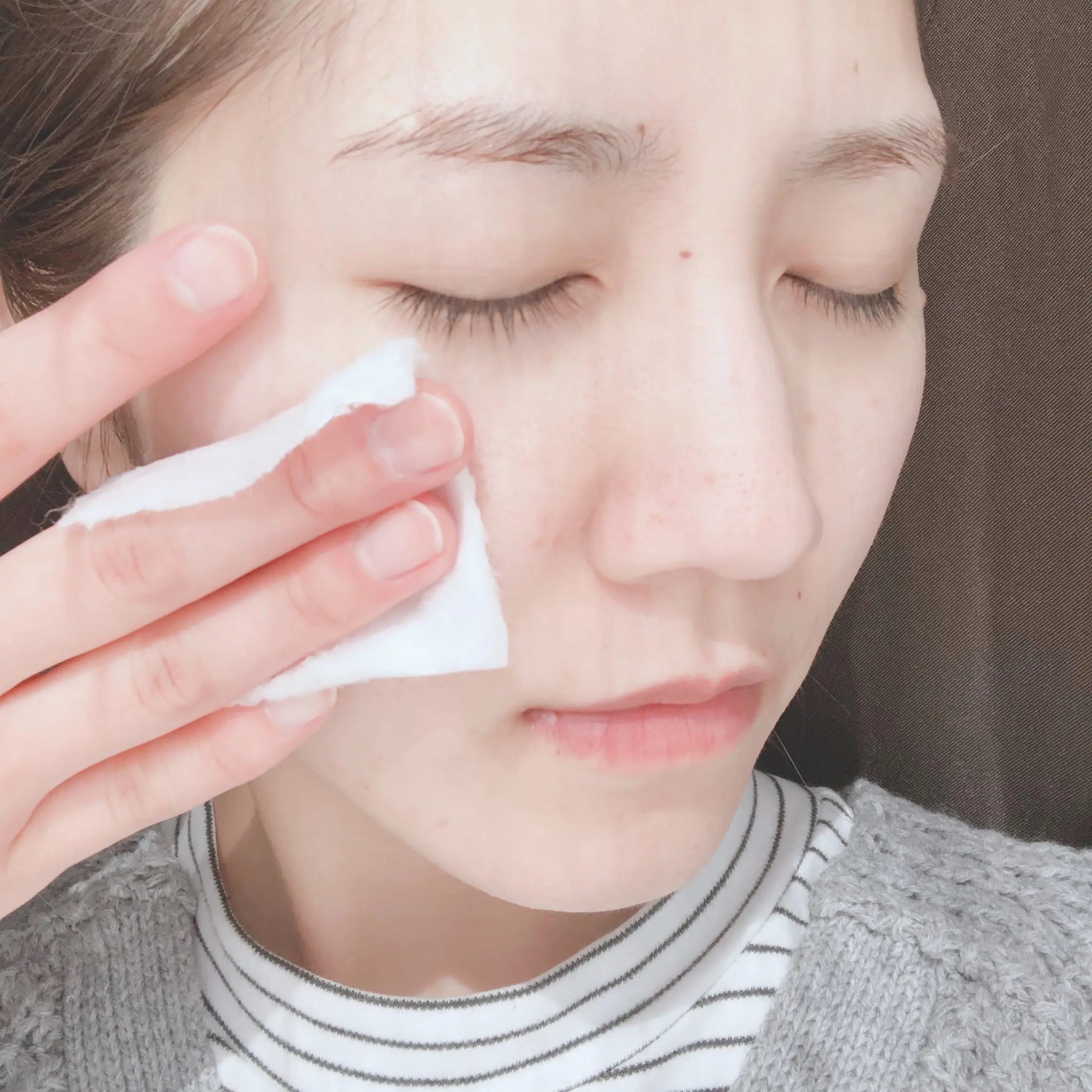 オードムーゲのふきとり化粧水でニキビのない健やかな肌を目指そう!_3