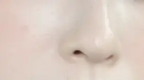 鼻のアップ