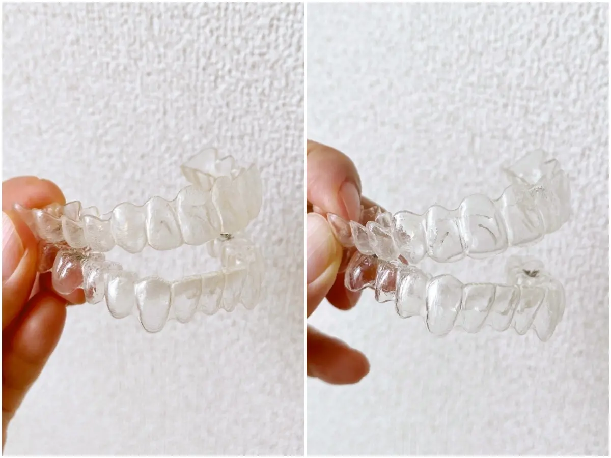 ポリデント「デンタルラボ」のマウスピース・マウスガード・矯正用リテーナー用洗浄剤の使い方