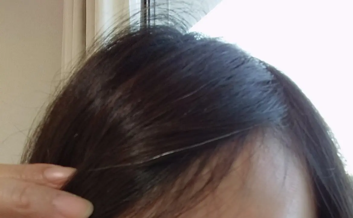 《秘密にしたいすごいヘアケア》ブラックリバース処方?!【白髪は染めるではなく戻す?!】ボズレーのヘアケアで白髪・抜け毛におさらば!_11