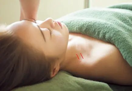 一発逆転・毛穴対策!たるみ毛穴を引き上げる美容鍼灸って?_2