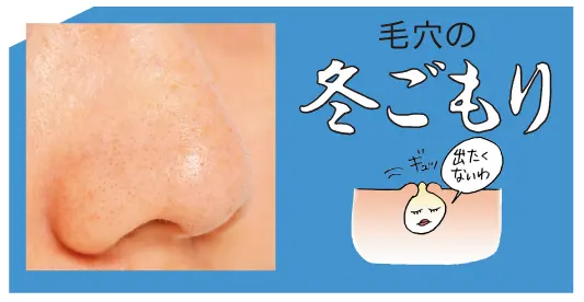 ほおっておくとニキビに!? 恐怖の「毛穴の冬ごもり」を撃退せよ! 【落とす編】_1