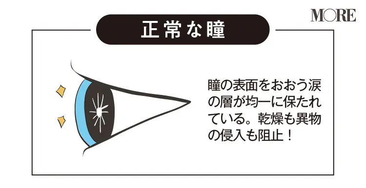 正常な瞳「瞳の表面をおおう涙の層が均一に保たれている。乾燥も異物の侵入も阻止できている状態」