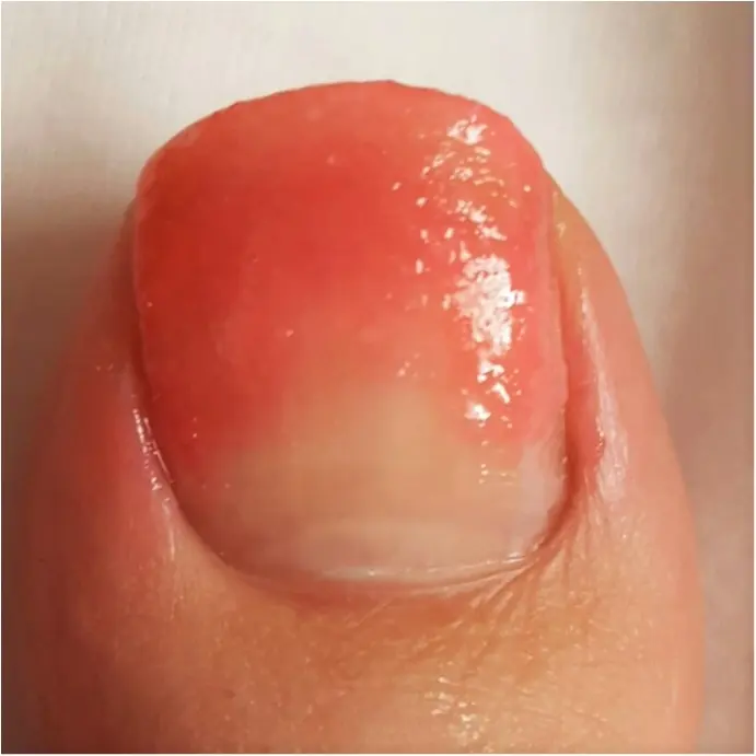 何味のシロップが好き?可愛くジューシーに指先を染める「かき氷」ネイル♡_3