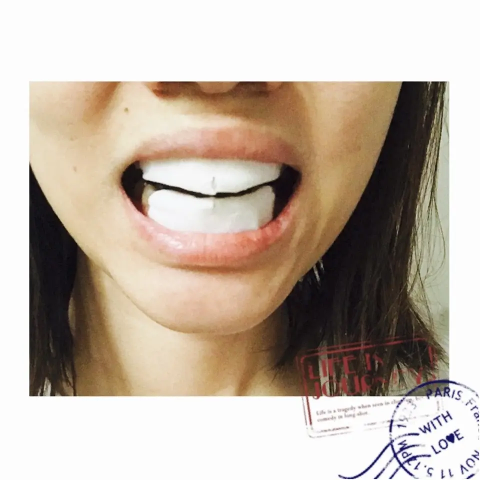 …ஐ 【Beauty】純白な白い歯へ⁺˳✧༚ モアハピかなな、“歯“の美白マスク始めました。!? ஐ¨_6