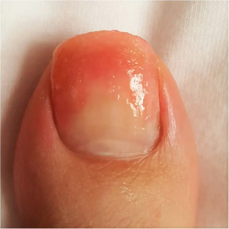 何味のシロップが好き?可愛くジューシーに指先を染める「かき氷」ネイル♡_2