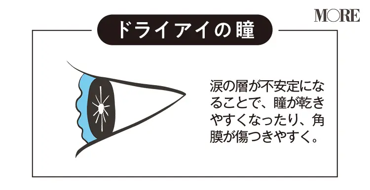 ドライアイの瞳「涙の層が不安定になることで、瞳が乾きやすくなったり、角膜が傷つきやすくなったりする」